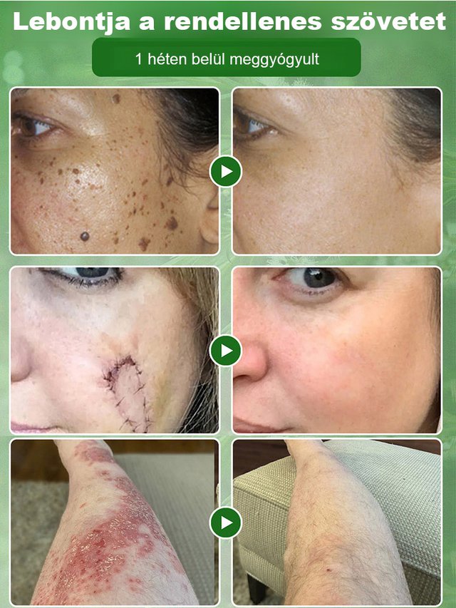 Tea fa olaj bőr javítási krém