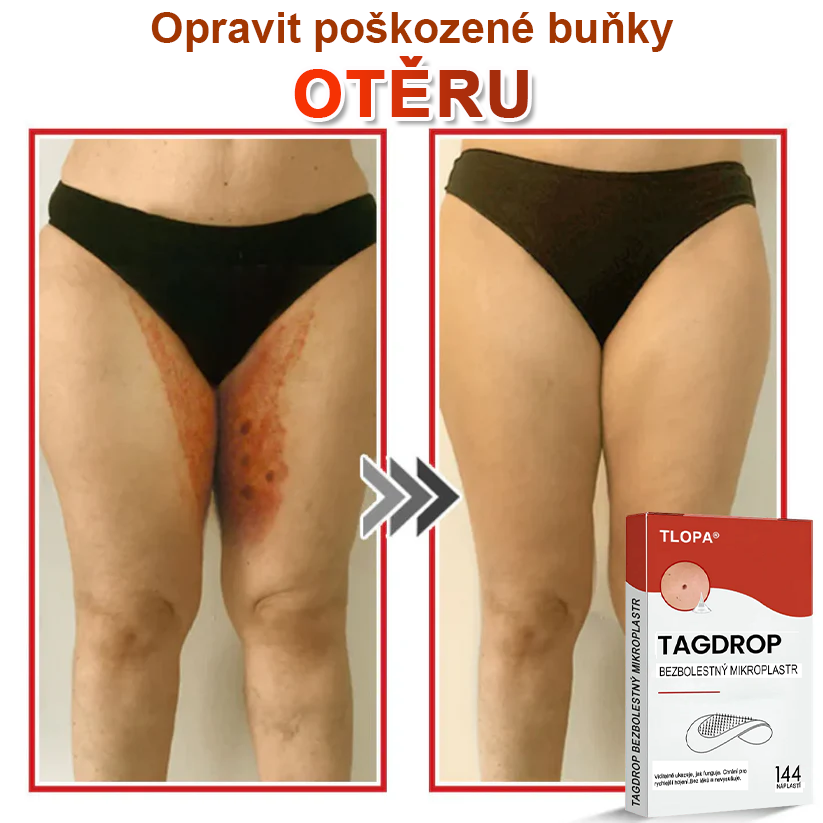 TLOPA® Mikrovpichová botanická náplast na odstranění kožních výrůstků 🇨🇿 Vyrobeno v Česká republika🇨🇿🇨🇿