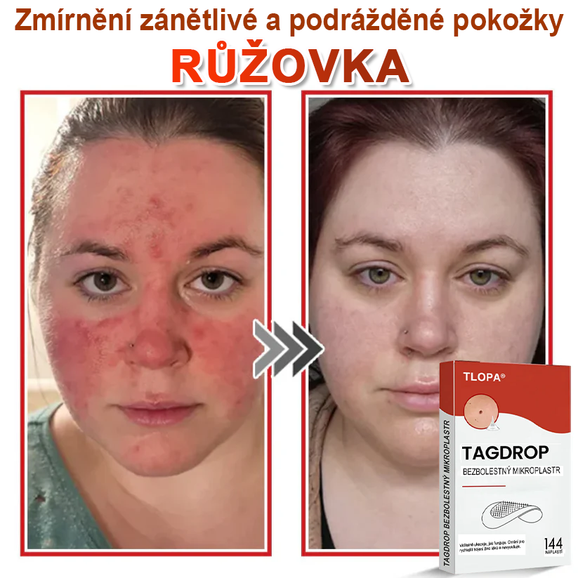 TLOPA® Mikrovpichová botanická náplast na odstranění kožních výrůstků 🇨🇿 Vyrobeno v Česká republika🇨🇿🇨🇿