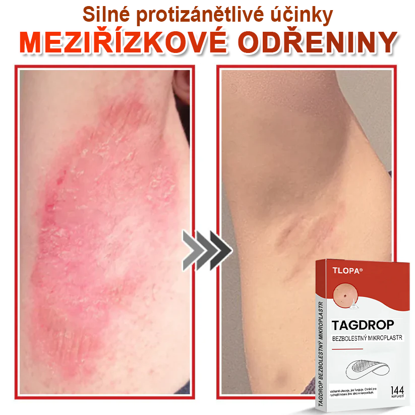 TLOPA® Mikrovpichová botanická náplast na odstranění kožních výrůstků 🇨🇿 Vyrobeno v Česká republika🇨🇿🇨🇿