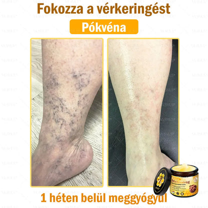 VLSVLS® Méhméreg Bőrhelyreállító Krém (👨‍⚕‍CE jóváhagyott)👍✅