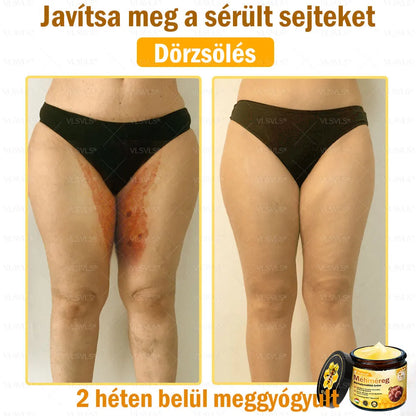 VLSVLS® Méhméreg Bőrhelyreállító Krém (👨‍⚕‍CE jóváhagyott)👍✅