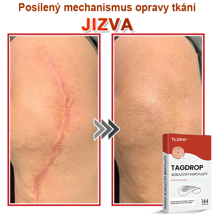 TLOPA® Mikrovpichová botanická náplast na odstranění kožních výrůstků 🇨🇿 Vyrobeno v Česká republika🇨🇿🇨🇿