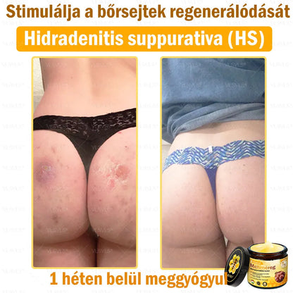 VLSVLS® Méhméreg Bőrhelyreállító Krém (👨‍⚕‍CE jóváhagyott)👍✅