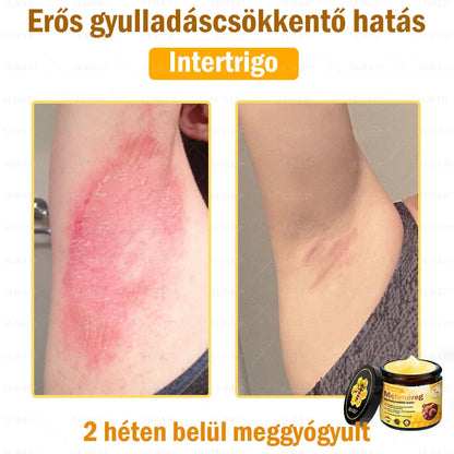 VLSVLS® Méhméreg Bőrhelyreállító Krém (👨‍⚕‍CE jóváhagyott)👍✅