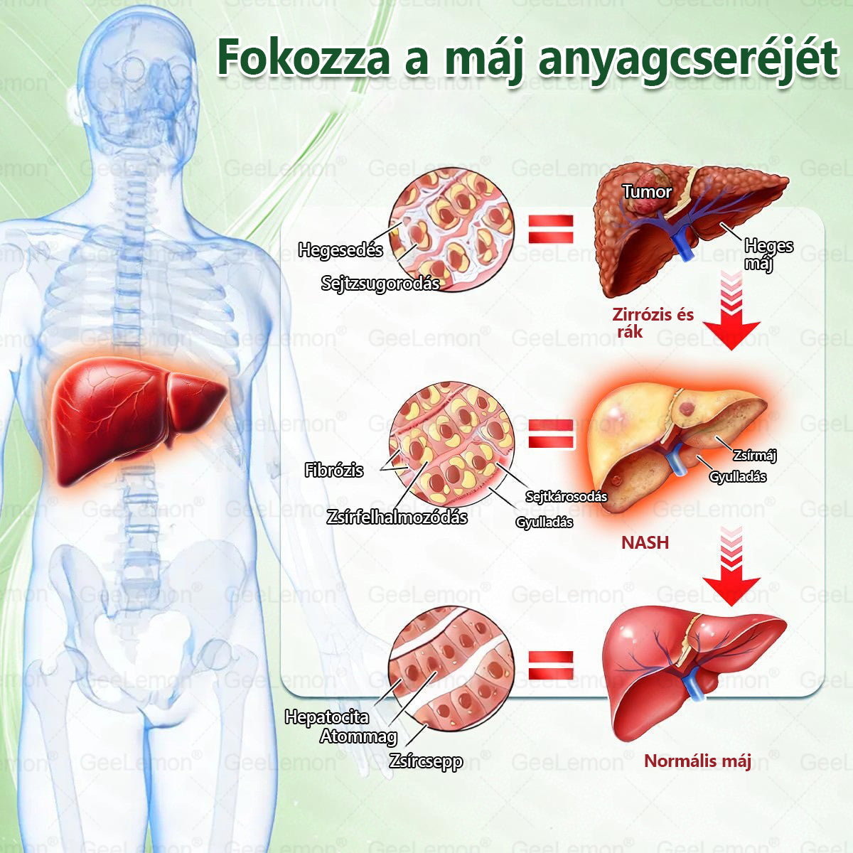 🌿Ajánlott a Semmelweis Kórház által · 👩‍⚕️BENU hivatalos üzlet| 🎁 𝐆𝐞𝑒𝐿𝑒𝐦𝐨𝐧® Glumasetide 8 az 1-ben Karcsú és Egészséges Nano Mikrotűs Tapasz 🇭🇺
