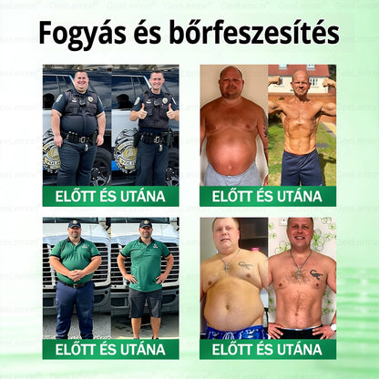 🌿Ajánlott a Semmelweis Kórház által · 👩‍⚕️BENU hivatalos üzlet| 🎁 𝐆𝐞𝑒𝐿𝑒𝐦𝐨𝐧® Glumasetide 8 az 1-ben Karcsú és Egészséges Nano Mikrotűs Tapasz 🇭🇺