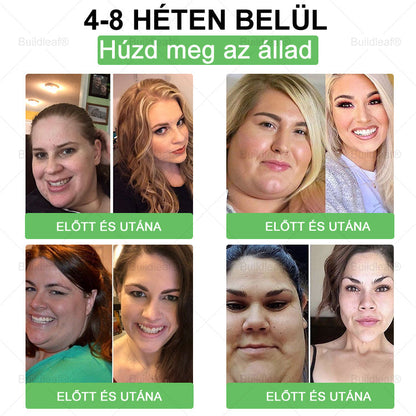 𝑩𝒖𝒊𝒍𝒅𝑳𝒆𝒂𝒇® 𝑮𝑳𝑷-1 6 𝒂𝒛 1-𝒃𝒆𝒏 𝒆𝒈é𝒔𝒛𝒔é𝒈ü𝒈𝒚𝒊 𝒐𝒍𝒅𝒂𝒕 𝒔𝒛á𝒋𝒐𝒏 á𝒕 𝒔𝒛𝒆𝒅𝒉𝒆𝒕ő 𝒇𝒐𝒍𝒚𝒂𝒅é𝒌 ✅ 𝑬𝒍𝒉í𝒛á𝒔, 𝒔𝒛í𝒗- é𝒔 é𝒓𝒓𝒆𝒏𝒅𝒔𝒛𝒆𝒓𝒊 𝒆𝒈é𝒔𝒛𝒔é𝒈, 𝒄𝒖𝒌𝒐𝒓𝒃𝒆𝒕𝒆𝒈𝒔é𝒈, 𝒂𝒍𝒗á𝒔𝒊 𝒂𝒑𝒏𝒐𝒆, 𝒃é𝒍𝒓𝒆𝒏𝒅𝒔𝒛𝒆𝒓𝒊 𝒆𝒈é𝒔𝒛𝒔é𝒈, í𝒛ü𝒍𝒆𝒕𝒊 𝒑𝒓𝒐𝒃𝒍é𝒎á𝒌 é𝒔 𝒆𝒈𝒚𝒆𝒃𝒆𝒌 𝒆𝒔𝒆𝒕é𝒏