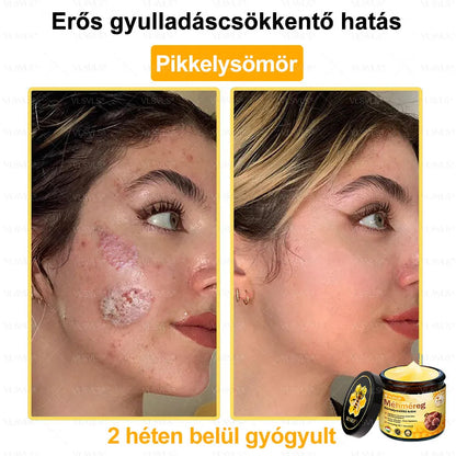 VLSVLS® Méhméreg Bőrhelyreállító Krém (👨‍⚕‍CE jóváhagyott)👍✅
