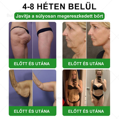 𝑩𝒖𝒊𝒍𝒅𝑳𝒆𝒂𝒇® 𝑮𝑳𝑷-1 6 𝒂𝒛 1-𝒃𝒆𝒏 𝒆𝒈é𝒔𝒛𝒔é𝒈ü𝒈𝒚𝒊 𝒐𝒍𝒅𝒂𝒕 𝒔𝒛á𝒋𝒐𝒏 á𝒕 𝒔𝒛𝒆𝒅𝒉𝒆𝒕ő 𝒇𝒐𝒍𝒚𝒂𝒅é𝒌 ✅ 𝑬𝒍𝒉í𝒛á𝒔, 𝒔𝒛í𝒗- é𝒔 é𝒓𝒓𝒆𝒏𝒅𝒔𝒛𝒆𝒓𝒊 𝒆𝒈é𝒔𝒛𝒔é𝒈, 𝒄𝒖𝒌𝒐𝒓𝒃𝒆𝒕𝒆𝒈𝒔é𝒈, 𝒂𝒍𝒗á𝒔𝒊 𝒂𝒑𝒏𝒐𝒆, 𝒃é𝒍𝒓𝒆𝒏𝒅𝒔𝒛𝒆𝒓𝒊 𝒆𝒈é𝒔𝒛𝒔é𝒈, í𝒛ü𝒍𝒆𝒕𝒊 𝒑𝒓𝒐𝒃𝒍é𝒎á𝒌 é𝒔 𝒆𝒈𝒚𝒆𝒃𝒆𝒌 𝒆𝒔𝒆𝒕é𝒏