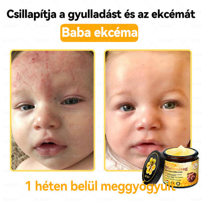 VLSVLS® Méhméreg Bőrhelyreállító Krém (👨‍⚕‍CE jóváhagyott)👍✅