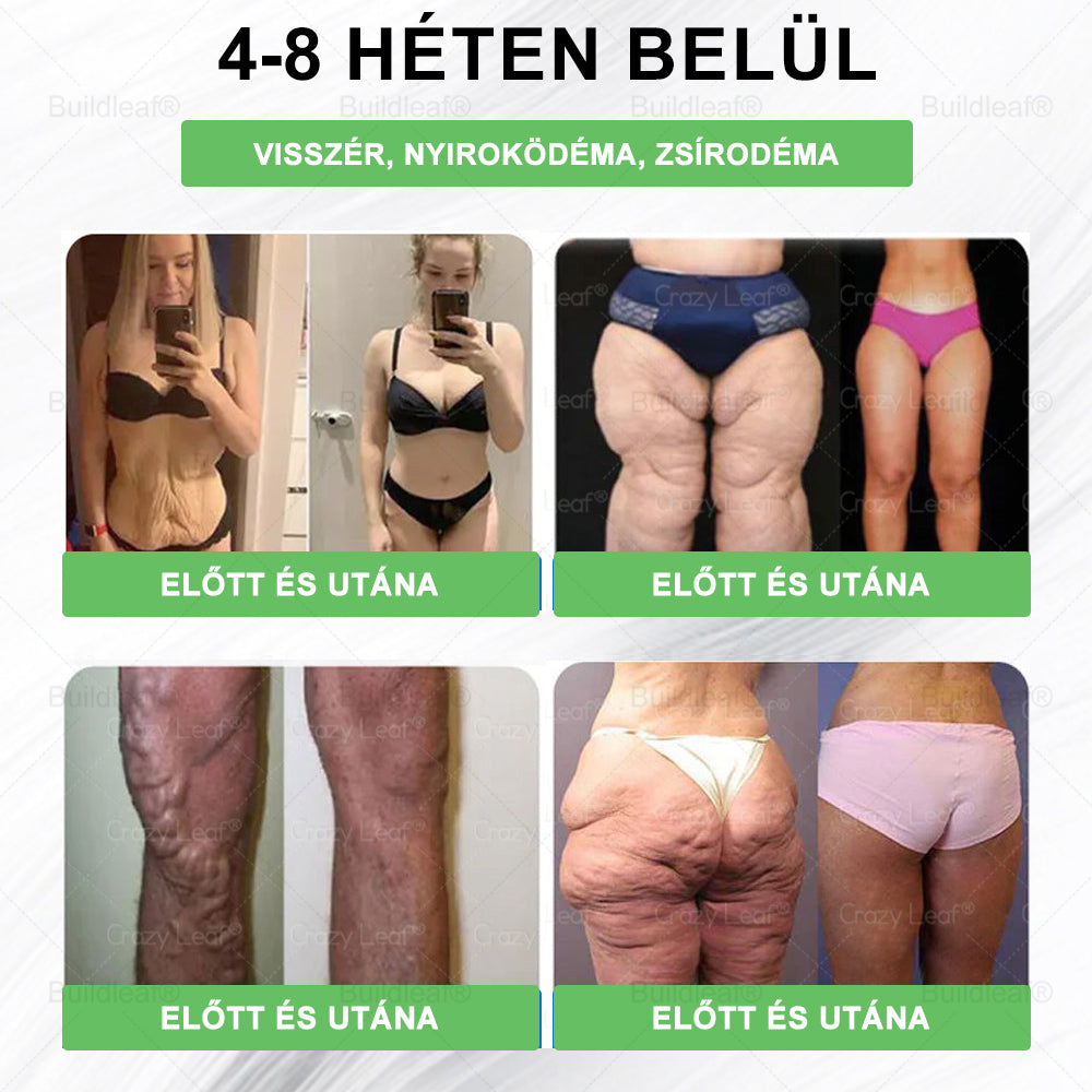 𝑩𝒖𝒊𝒍𝒅𝑳𝒆𝒂𝒇® 𝑮𝑳𝑷-1 6 𝒂𝒛 1-𝒃𝒆𝒏 𝒆𝒈é𝒔𝒛𝒔é𝒈ü𝒈𝒚𝒊 𝒐𝒍𝒅𝒂𝒕 𝒔𝒛á𝒋𝒐𝒏 á𝒕 𝒔𝒛𝒆𝒅𝒉𝒆𝒕ő 𝒇𝒐𝒍𝒚𝒂𝒅é𝒌 ✅ 𝑬𝒍𝒉í𝒛á𝒔, 𝒔𝒛í𝒗- é𝒔 é𝒓𝒓𝒆𝒏𝒅𝒔𝒛𝒆𝒓𝒊 𝒆𝒈é𝒔𝒛𝒔é𝒈, 𝒄𝒖𝒌𝒐𝒓𝒃𝒆𝒕𝒆𝒈𝒔é𝒈, 𝒂𝒍𝒗á𝒔𝒊 𝒂𝒑𝒏𝒐𝒆, 𝒃é𝒍𝒓𝒆𝒏𝒅𝒔𝒛𝒆𝒓𝒊 𝒆𝒈é𝒔𝒛𝒔é𝒈, í𝒛ü𝒍𝒆𝒕𝒊 𝒑𝒓𝒐𝒃𝒍é𝒎á𝒌 é𝒔 𝒆𝒈𝒚𝒆𝒃𝒆𝒌 𝒆𝒔𝒆𝒕é𝒏