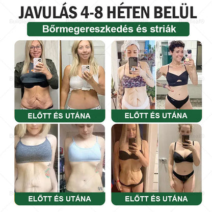 𝑩𝒖𝒊𝒍𝒅𝑳𝒆𝒂𝒇® 𝑮𝑳𝑷-1 6 𝒂𝒛 1-𝒃𝒆𝒏 𝒆𝒈é𝒔𝒛𝒔é𝒈ü𝒈𝒚𝒊 𝒐𝒍𝒅𝒂𝒕 𝒔𝒛á𝒋𝒐𝒏 á𝒕 𝒔𝒛𝒆𝒅𝒉𝒆𝒕ő 𝒇𝒐𝒍𝒚𝒂𝒅é𝒌 ✅ 𝑬𝒍𝒉í𝒛á𝒔, 𝒔𝒛í𝒗- é𝒔 é𝒓𝒓𝒆𝒏𝒅𝒔𝒛𝒆𝒓𝒊 𝒆𝒈é𝒔𝒛𝒔é𝒈, 𝒄𝒖𝒌𝒐𝒓𝒃𝒆𝒕𝒆𝒈𝒔é𝒈, 𝒂𝒍𝒗á𝒔𝒊 𝒂𝒑𝒏𝒐𝒆, 𝒃é𝒍𝒓𝒆𝒏𝒅𝒔𝒛𝒆𝒓𝒊 𝒆𝒈é𝒔𝒛𝒔é𝒈, í𝒛ü𝒍𝒆𝒕𝒊 𝒑𝒓𝒐𝒃𝒍é𝒎á𝒌 é𝒔 𝒆𝒈𝒚𝒆𝒃𝒆𝒌 𝒆𝒔𝒆𝒕é𝒏