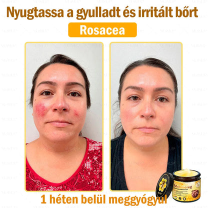 VLSVLS® Méhméreg Bőrhelyreállító Krém (👨‍⚕‍CE jóváhagyott)👍✅