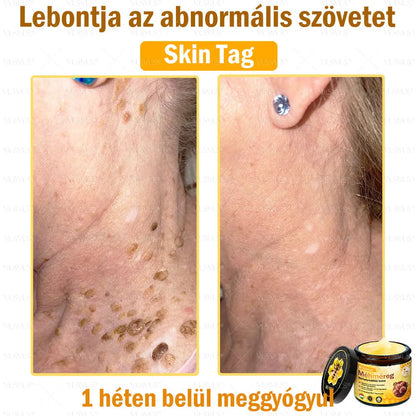VLSVLS® Méhméreg Bőrhelyreállító Krém (👨‍⚕‍CE jóváhagyott)👍✅