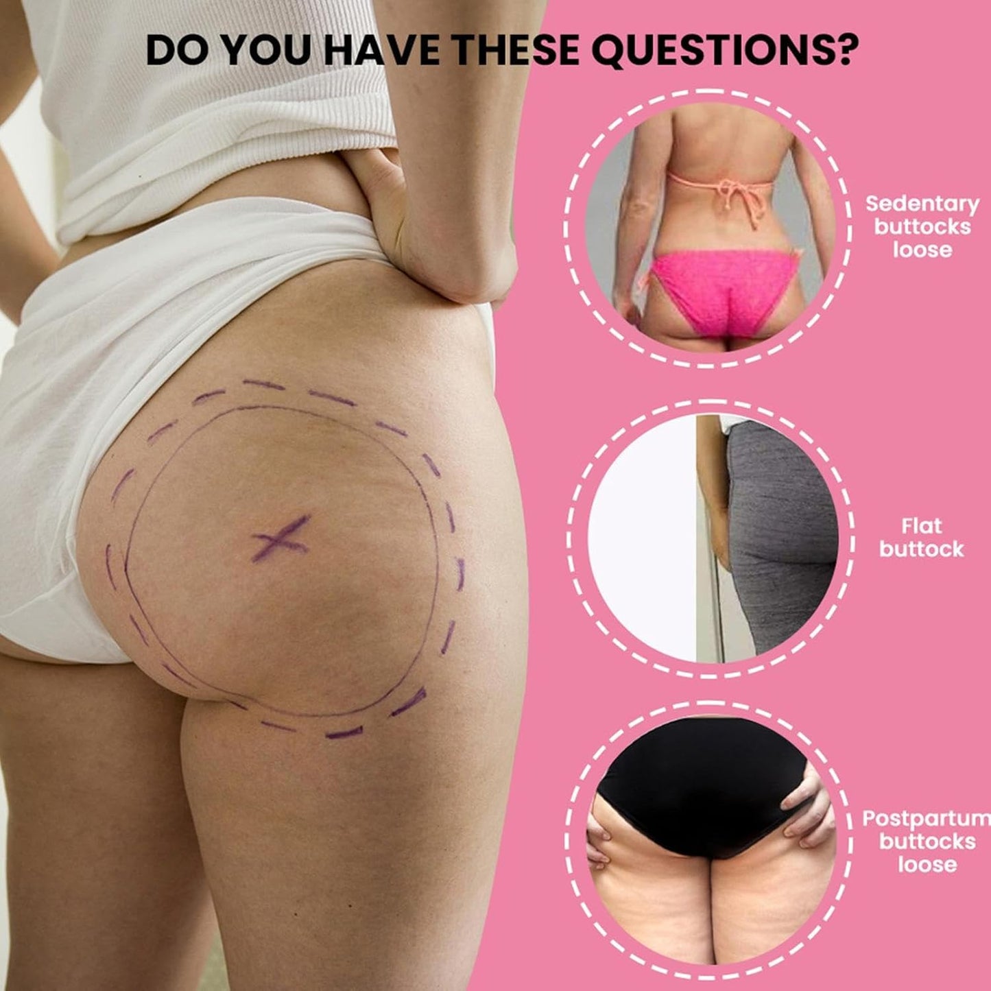 Fenékfeszesítő És -Nagyobbító Krém