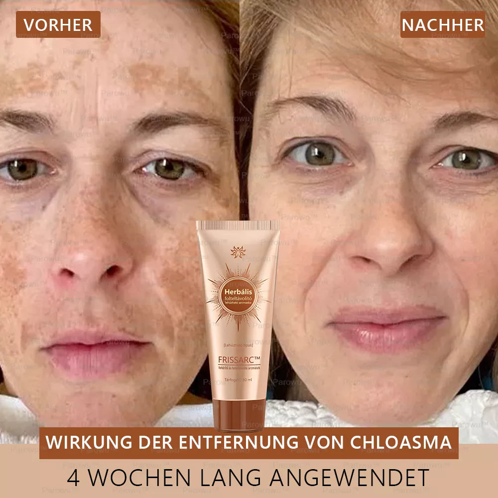 💟FRISSARC™ fehérítő és folteltávolító arcmaszk –👩‍⚕️Természetes összetevők tartósan eltüntetik a foltokat, szeplőket és napfoltokat.