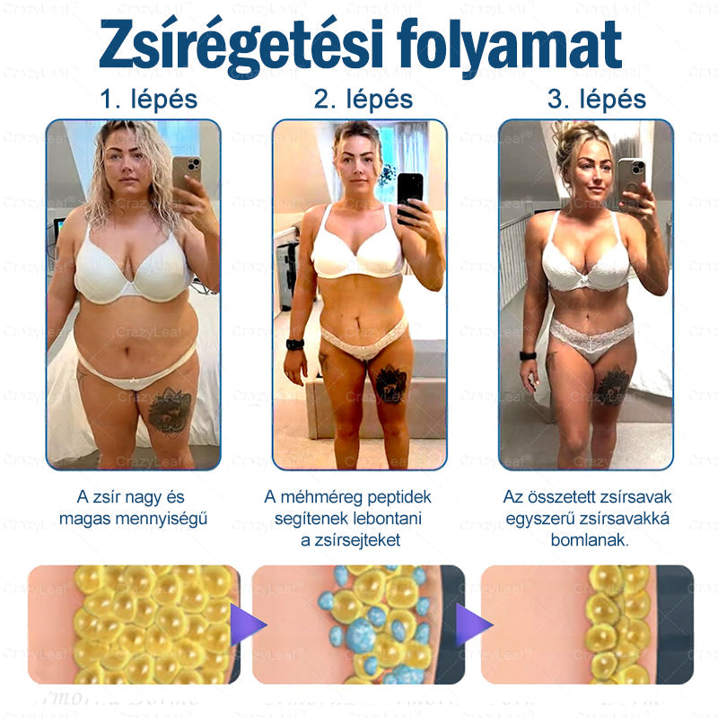 Klinikailag igazolt Magyarországon | Hivatalos áruház | CrazyLeaf® Slim & Vitality szájon át szedhető oldat makacs fogyás, magas vérnyomás, vércukorszint, zsírmáj, ízületi fájdalom, alacsony energiaszint és laza bőr esetén
