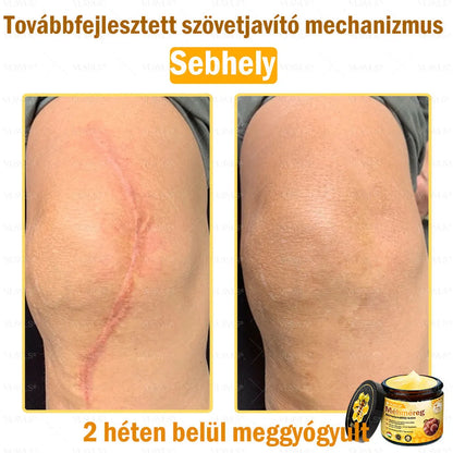 VLSVLS® Méhméreg Bőrhelyreállító Krém (👨‍⚕‍CE jóváhagyott)👍✅