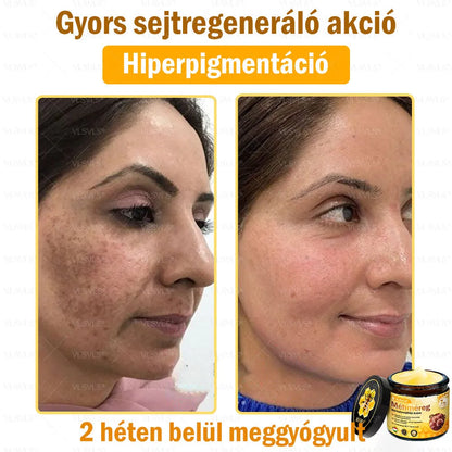 VLSVLS® Méhméreg Bőrhelyreállító Krém (👨‍⚕‍CE jóváhagyott)👍✅