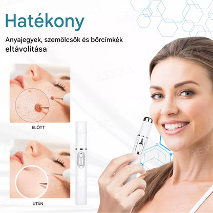 Bikenda® non-invazív anyajegy- és szemölcseltávolító lézertoll