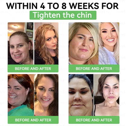 CrazyLeaf® SMGT-GLP-1 karcsúság & vitalitás orális oldat célpontjai a makacs testsúly, magas vérnyomás, vércukorszint, zsírmáj, ízületi fájdalom, fáradtság, alacsony energia, megereszkedett bőr és még sok más a jobb egészség és vitalitás érdekében.