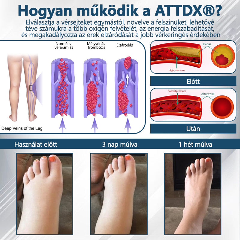 💧💧💧ATTDX® Növényi ödéma enyhítő krém nigellával