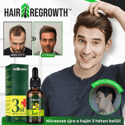 HairRegrowth™ | Hosszabb haj mindössze 3 hét alatt!!