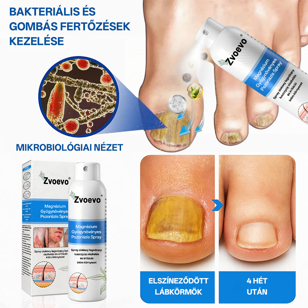 Zvoevo® Magnézium Gyógynövényes Pszoriázis Spray✨