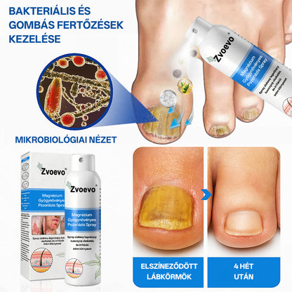 Zvoevo® Magnézium Gyógynövényes Pszoriázis Spray✨