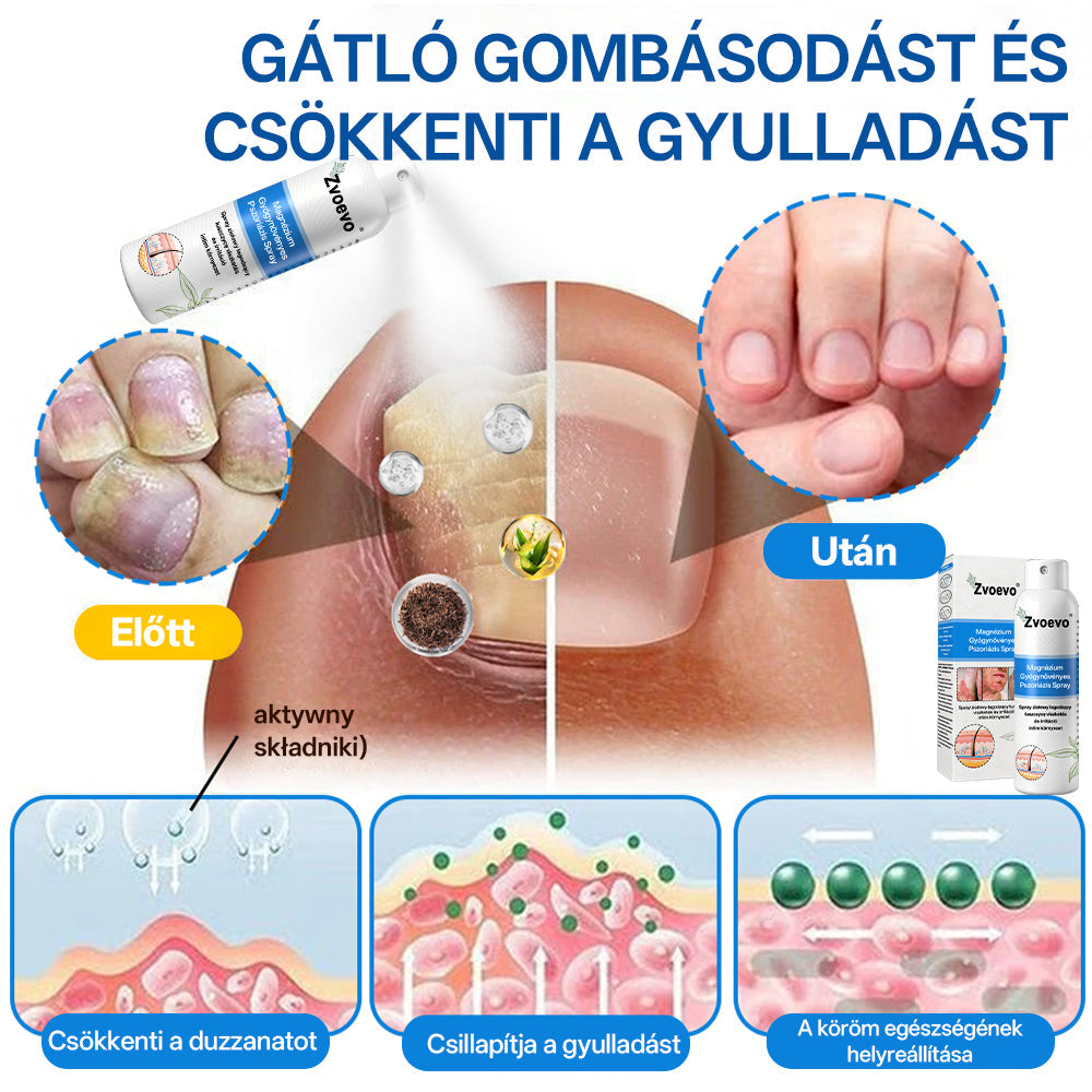 Zvoevo® Magnézium Gyógynövényes Pszoriázis Spray✨