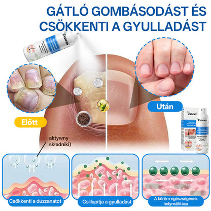 Zvoevo® Magnézium Gyógynövényes Pszoriázis Spray✨