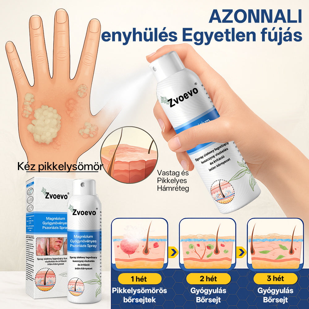 Zvoevo® Magnézium Gyógynövényes Pszoriázis Spray✨