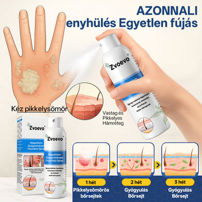 Zvoevo® Magnézium Gyógynövényes Pszoriázis Spray✨