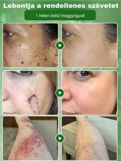 Tea fa olaj bőr javítási krém