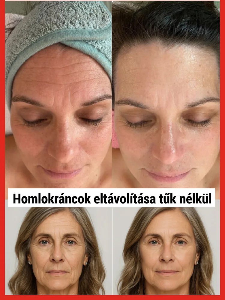 Lazac aktív oxigén víz fény gél anyalé esszencia