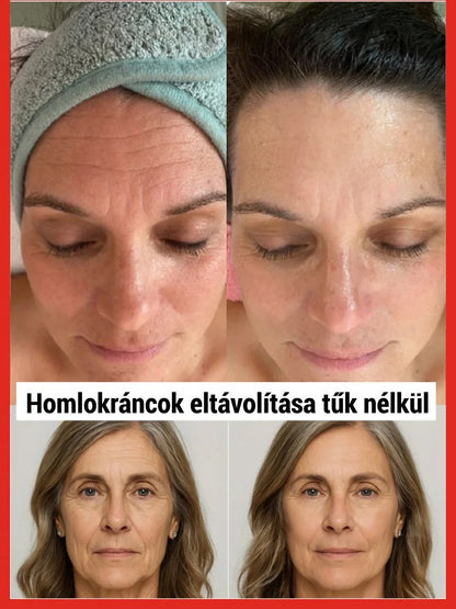 Lazac aktív oxigén víz fény gél anyalé esszencia