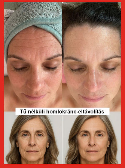 Lazac vízfény ránctalanító szérum - Egy érintéssel eltávolíthatja a ráncokat