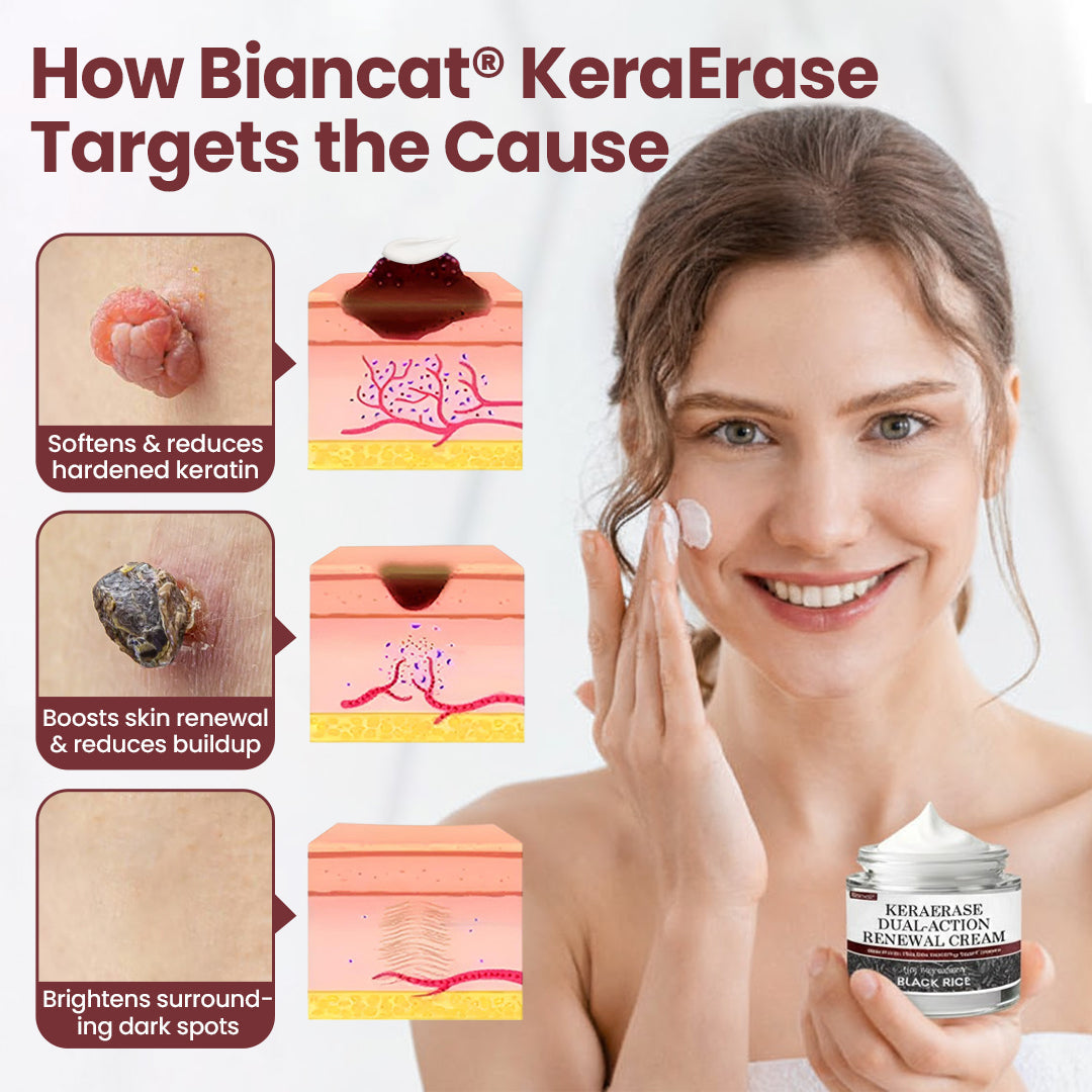 Biancat® KeraErase Dual-Action Renewal Cream