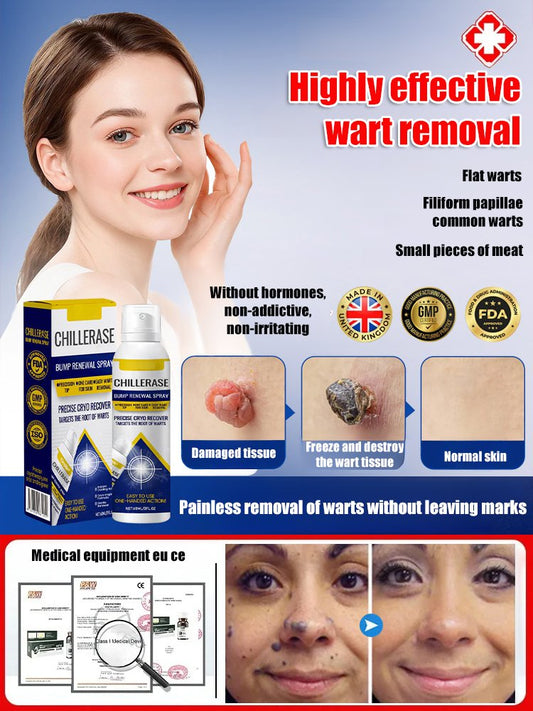 [Wart Removal Without Recurrence] Topical Skin Care Spray