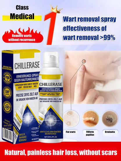 [Wart Removal Without Recurrence] Topical Skin Care Spray