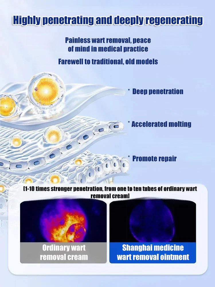 [Wart Removal Without Recurrence] Topical Skin Care Spray