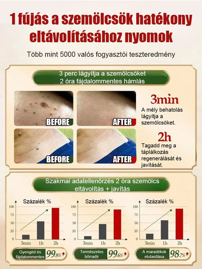 Bőrszemölcs külső ápoló permet Bőrszemölcs külső ápoló permet ！！！Mondj búcsút a szemölcsöknek, légy magabiztos minden pillanatban!