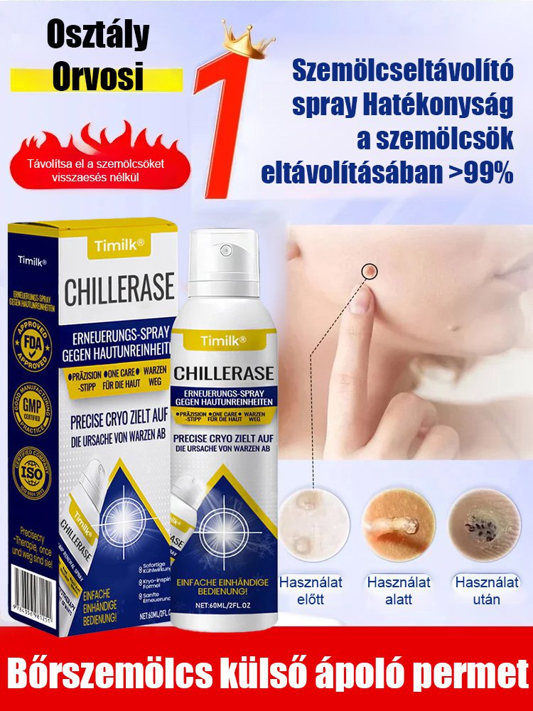 Bőrszemölcs külső ápoló permet Bőrszemölcs külső ápoló permet ！！！Mondj búcsút a szemölcsöknek, légy magabiztos minden pillanatban!