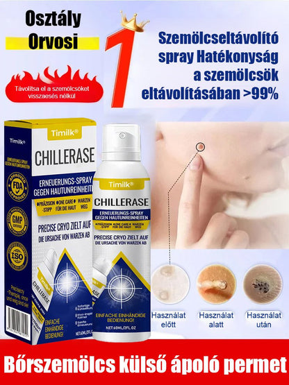 Bőrszemölcs külső ápoló permet Bőrszemölcs külső ápoló permet ！！！Mondj búcsút a szemölcsöknek, légy magabiztos minden pillanatban!