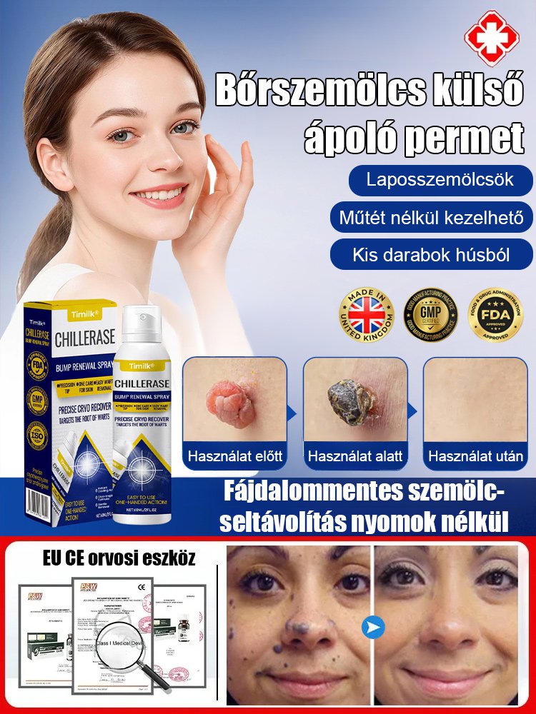 Bőrszemölcs külső ápoló permet Bőrszemölcs külső ápoló permet ！！！Mondj búcsút a szemölcsöknek, légy magabiztos minden pillanatban!