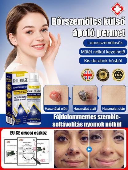 Bőrszemölcs külső ápoló permet Bőrszemölcs külső ápoló permet ！！！Mondj búcsút a szemölcsöknek, légy magabiztos minden pillanatban!