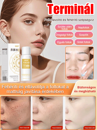 【Arcfoltok eltávolítása】Folteltávolító permet - Egy spray az arc foltjainak eltávolítására, szuper hatékony!!