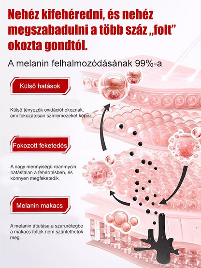 【Arcfoltok eltávolítása】Folteltávolító permet - Egy spray az arc foltjainak eltávolítására, szuper hatékony!!