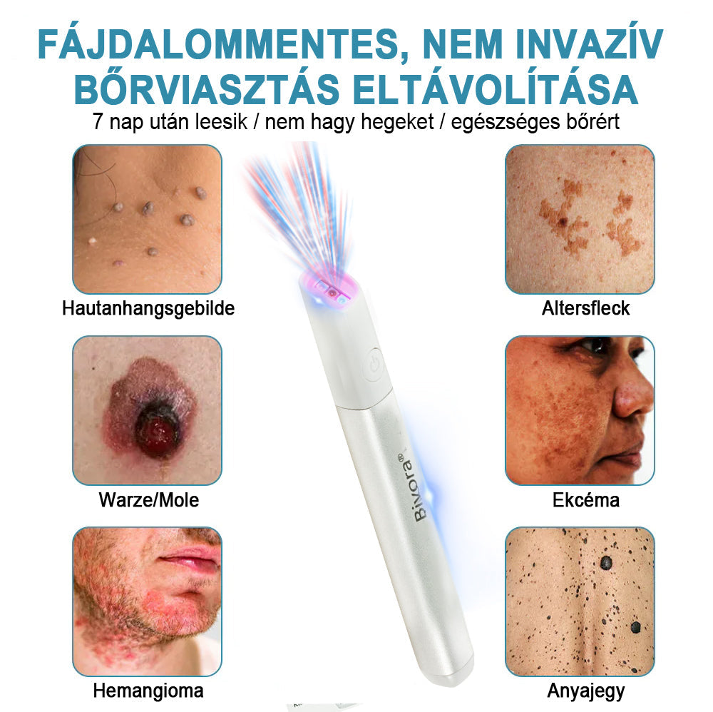Bivora®✨ VelvetSkin+ – CO₂ lézeres toll a 🟤 anyajegyek, 🦠 szemölcsök, 🔘 pigmentfoltok és egyéb bőrhibák eltávolítására 🩹